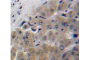 IHC-P analysis of Liver tissue, with DAB staining. (Apolipoprotein F antibody  (AA 122-307))