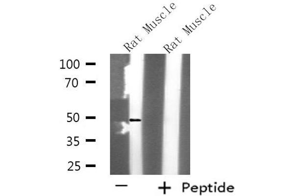 KCNK12 antibody  (N-Term)