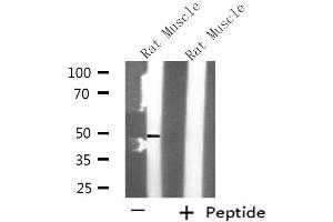 Western blot analysis of extracts from Rat muscle, using KCNK12 antibody. (KCNK12 antibody  (N-Term))