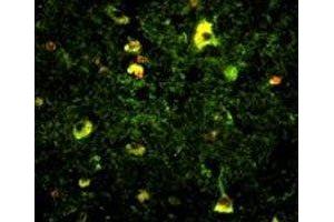 Immunofluorescence analysis of Rab5 antibody with paraffin-embedded human brain tissue. (RAB5 antibody  (AA 182-211))