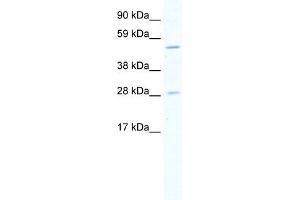 WB Suggested Anti-ASCL2 Antibody Titration:  5. (ASCL2 antibody  (Middle Region))