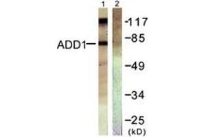 Western blot analysis of extracts from HeLa cells, treated with Forskolin 40nM 30', using ADD1 (Ab-726) Antibody. (alpha Adducin antibody  (AA 688-737))