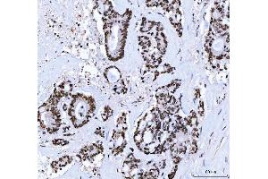 IHC analysis of CTBP2 using anti-CTBP2 antibody (ABIN7601326). (CTBP2 antibody  (AA 321-445))