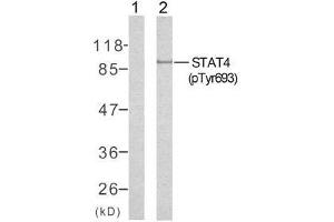 Western blot analysis of extracts from HeLa cells using STAT4 (phospho-Tyr693) antibody (E011047). (STAT4 antibody  (pTyr693))