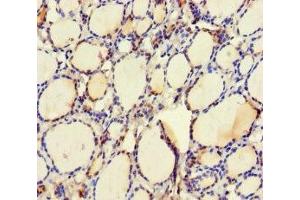 Immunohistochemistry of paraffin-embedded human thyroid tissue using ABIN7174476 at dilution of 1:100 (UBE2Q2 antibody  (AA 1-375))