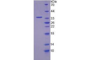 Image no. 1 for Transketolase (TKT) (AA 1-286) protein (His tag) (ABIN4990645) (TKT Protein (AA 1-286) (His tag))