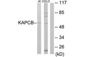 Western Blotting (WB) image for anti-Protein Kinase, CAMP Dependent, Catalytic, beta (PRKACB) (AA 291-340) antibody (ABIN2889425) (PRKACB antibody  (AA 291-340))