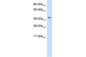 Western Blotting (WB) image for anti-Male-Specific Lethal 3 Homolog (MSL3) antibody (ABIN2461970) (MSL3 antibody)