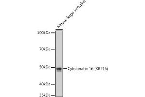 Western blot analysis of extracts of Mouse large intestine cells, using Cytokeratin 16 (KRT16) antibody (ABIN7268094) at 1:1000 dilution. (KRT16 antibody)