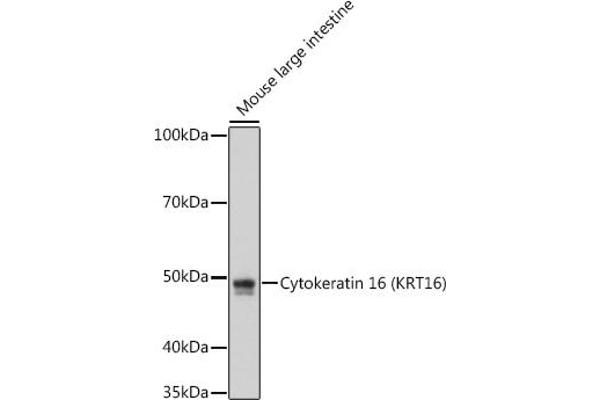 KRT16 anticorps