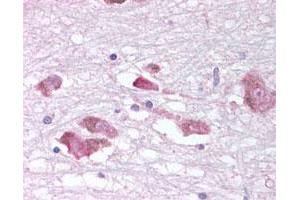 Immunohistochemical (Formalin/PFA-fixed paraffin-embedded sections) staining of human substantia nigra in brain.