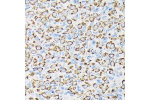 Immunohistochemistry of paraffin-embedded rat ovary using NDUFS4 Rabbit mAb (ABIN7268821) at dilution of 1:100 (40x lens). (NDUFS4 antibody)