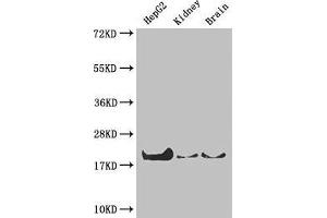 Western Blot Positive WB detected in: HepG2 whole cell lysate, Mouse kidney tissue, Mouse brain tissue All lanes: PPIA antibody at 4 μg/mL Secondary Goat polyclonal to rabbit IgG at 1/50000 dilution Predicted band size: 19, 12 kDa Observed band size: 19 kDa (PPIA antibody  (AA 1-165))