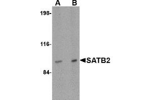 Western Blotting (WB) image for anti-SATB Homeobox 2 (SATB2) (N-Term) antibody (ABIN1031555) (SATB2 antibody  (N-Term))