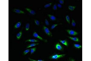 Immunofluorescent analysis of Hela cells using ABIN7152238 at dilution of 1:100 and Alexa Fluor 488-congugated AffiniPure Goat Anti-Rabbit IgG(H+L) (SLC1A6 antibody  (AA 149-271))