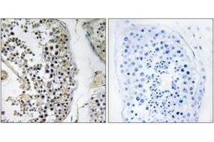 Immunohistochemistry analysis of paraffin-embedded human testis tissue, using CEP170 Antibody.