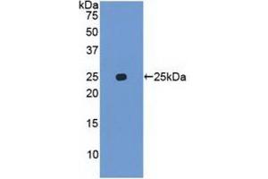 Detection of Recombinant UBD, Human using Polyclonal Antibody to Ubiquitin D (UBD) (UBD antibody  (AA 1-165))