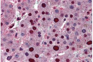 Human Liver: Formalin-Fixed, Paraffin-Embedded (FFPE) (PHAP1 antibody  (AA 1-250))