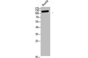 Western blot analysis of hepg2 Cell Lysate, antibody was diluted at 1:1000 (TERT antibody  (AA 1268-1341))