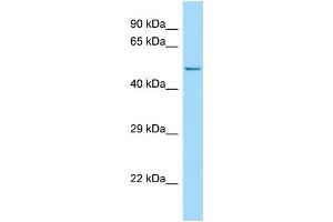 WB Suggested Anti-FLVCR2 Antibody Titration: 1. (FLVCR2 antibody  (C-Term))