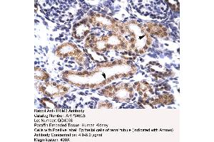Human kidney (TRIM3 antibody  (N-Term))