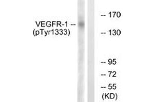 Western blot analysis of extracts from K562 cells treated with etoposide 25uM 24h, using VEGFR1 (Phospho-Tyr1333) Antibody.