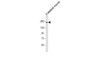 Anti-MYH7 Antibody (N-term) at 1:1000 dilution + human skeletal muscle lysate Lysates/proteins at 20 μg per lane. (MYH7 antibody  (N-Term))