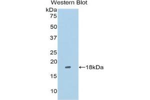Western blot analysis of the recombinant protein. (LRRFIP1 antibody  (AA 128-250))