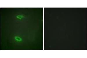 Immunofluorescence analysis of HeLa cells, using DLGP1 Antibody. (DLGAP1 antibody  (AA 791-840))