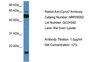 WB Suggested Anti-Cpne7  Antibody Titration: 0. (CPNE7 antibody  (C-Term))