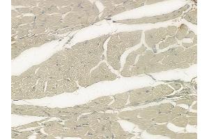 ABIN6259225 and ABIN6273402 at 1/100 staining human tongue carcinoma by IHC-P.