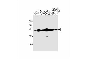 All lanes : Anti-RAB1B Antibody (C-term) at 1:2000 dilution Lane 1: 293 whole cell lysate Lane 2: A431 whole cell lysate Lane 3: Hela whole cell lysate Lane 4: T47D whole cell lysate Lane 5: U-87 MG whole cell lysate Lane 6: NIH/3T3 whole cell lysate Lane 7: rat liver lysate Lysates/proteins at 20 μg per lane. (RAB1B antibody  (C-Term))