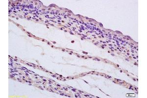 Immunohistochemistry (Paraffin-embedded Sections) (IHC (p)) image for anti-SHC (Src Homology 2 Domain Containing) Transforming Protein 1 (SHC1) (AA 481-583) antibody (ABIN700990)