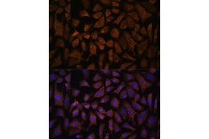 Immunofluorescence analysis of L929 cells using PP2A-B56δ/PR61δ/PP2A-B56δ/PR61δ/PPP2R5D antibody (ABIN7269690) at dilution of 1:100.