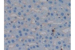 Immunohistochemistry (IHC) image for anti-Intercellular Adhesion Molecule 1 (ICAM1) (AA 102-306) antibody (ABIN7431977)