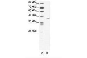 Image no. 1 for anti-Forkhead Box L2 (FOXL2) (N-Term) antibody (ABIN202373) (FOXL2 antibody  (N-Term))