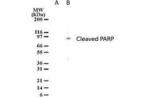 Image no. 1 for anti-Poly (ADP-Ribose) Polymerase 1 (PARP1) antibody (ABIN207909) (PARP1 antibody)