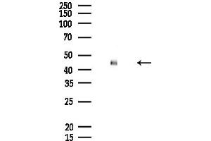 Western blot analysis of lysates from Rat liver, using UR Antibody at 1/1000 dilution.