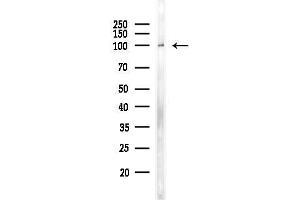 anti-Ewing Tumor-Associated Antigen 1 (ETAA1) (Internal Region) antibody