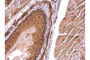 IHC-P Image Monoglyceride lipase antibody detects Monoglyceride lipase protein at nucleus on mouse esophagus by immunohistochemical analysis. (MGLL antibody)