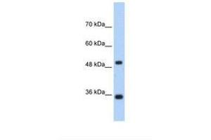 Image no. 1 for anti-Fructose-1,6-Bisphosphatase 1 (FBP1) (AA 114-163) antibody (ABIN1494672) (FBP1 antibody  (AA 114-163))