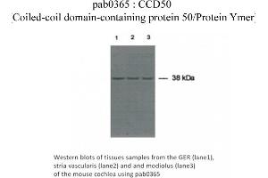 Image no. 1 for anti-Coiled-Coil Domain Containing 50 (CCDC50) (C-Term) antibody (ABIN347393) (CCDC50 antibody  (C-Term))
