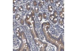 Immunohistochemical staining of human duodenum with MAMDC2 polyclonal antibody  shows moderate cytoplasmic positivity in glandular cells.