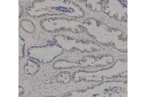 IHC analysis of ADK using anti-ADK antibody (ABIN4886430). (ADK antibody  (AA 165-351))