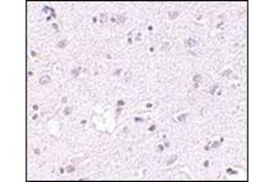 Immunohistochemistry of LASS5 in human brain tissue with this product at 2.
