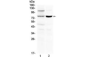 Western blot testing of 1) rat liver and 2) mouse kidney lysate with Dishevelled 2 antibody at 0.