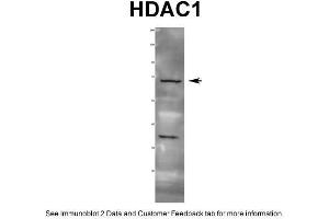 WB Suggested Anti-HDAC1 Antibody  Titration: 1 ug/ml Positive Control: Rat tissue (HDAC1 antibody  (C-Term))