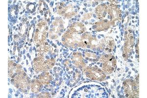 UROD antibody was used for immunohistochemistry at a concentration of 4-8 ug/ml to stain Epithelial cells of renal tubule (arrows) in Human Kidney.