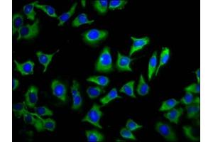 Immunofluorescence staining of A549 cells with ABIN7173285 at 1:133, counter-stained with DAPI. (TMEM88 antibody  (AA 109-159))