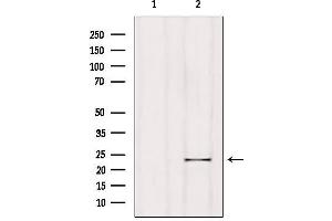 Western blot analysis of extracts from Hela, using RGS1 Antibody.